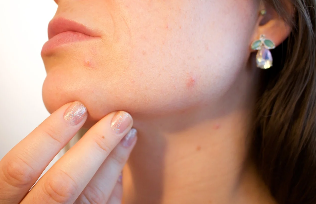 Tips to Maintain Your Skin Health